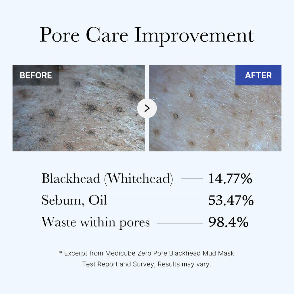 [GIFT] Zero Pore Blackhead Mud Mask - medicube.us