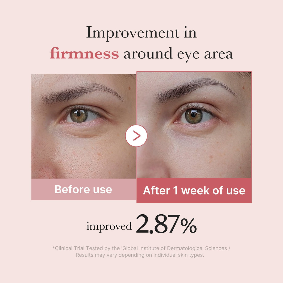 PDRN Pink Peptide Eye Cream - medicube.us