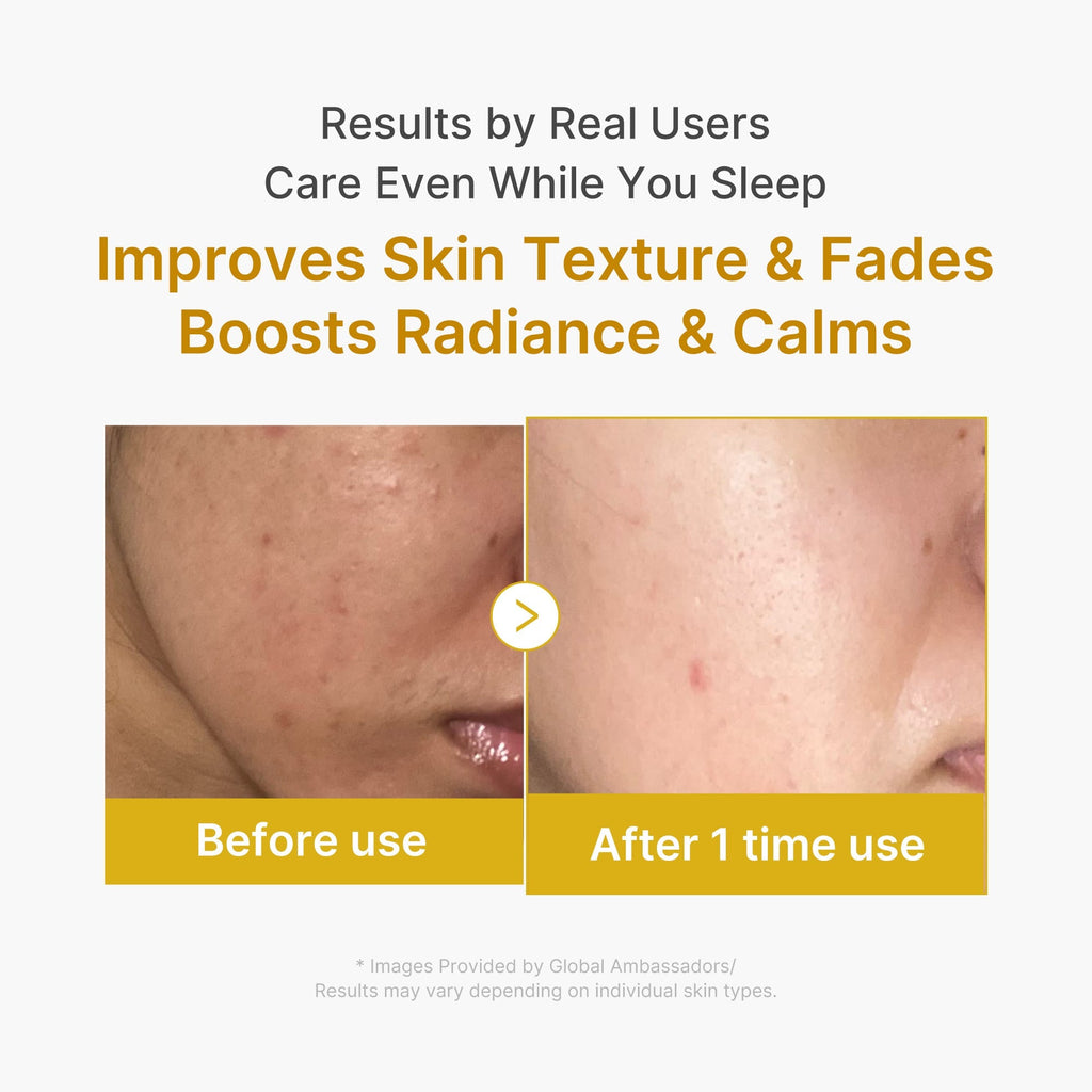 [Subscr.] Kojic Acid Turmeric Overnight Wrapping Mask