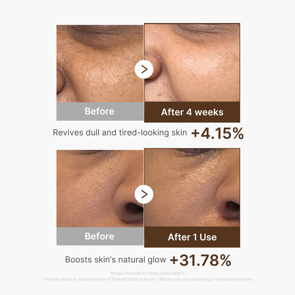 Deep Vitamin C Capsule Serum - medicube.us