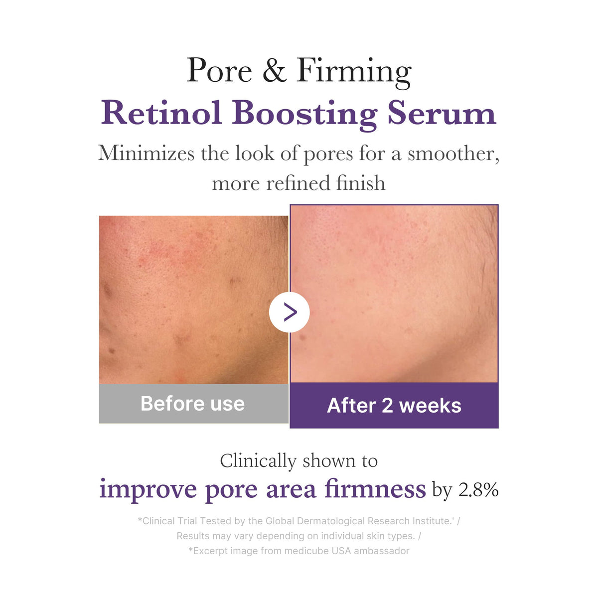 Retinol NMN Boosting Serum - medicube.us